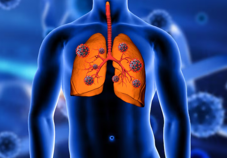 Best Lung Infection Treatment In Borivali